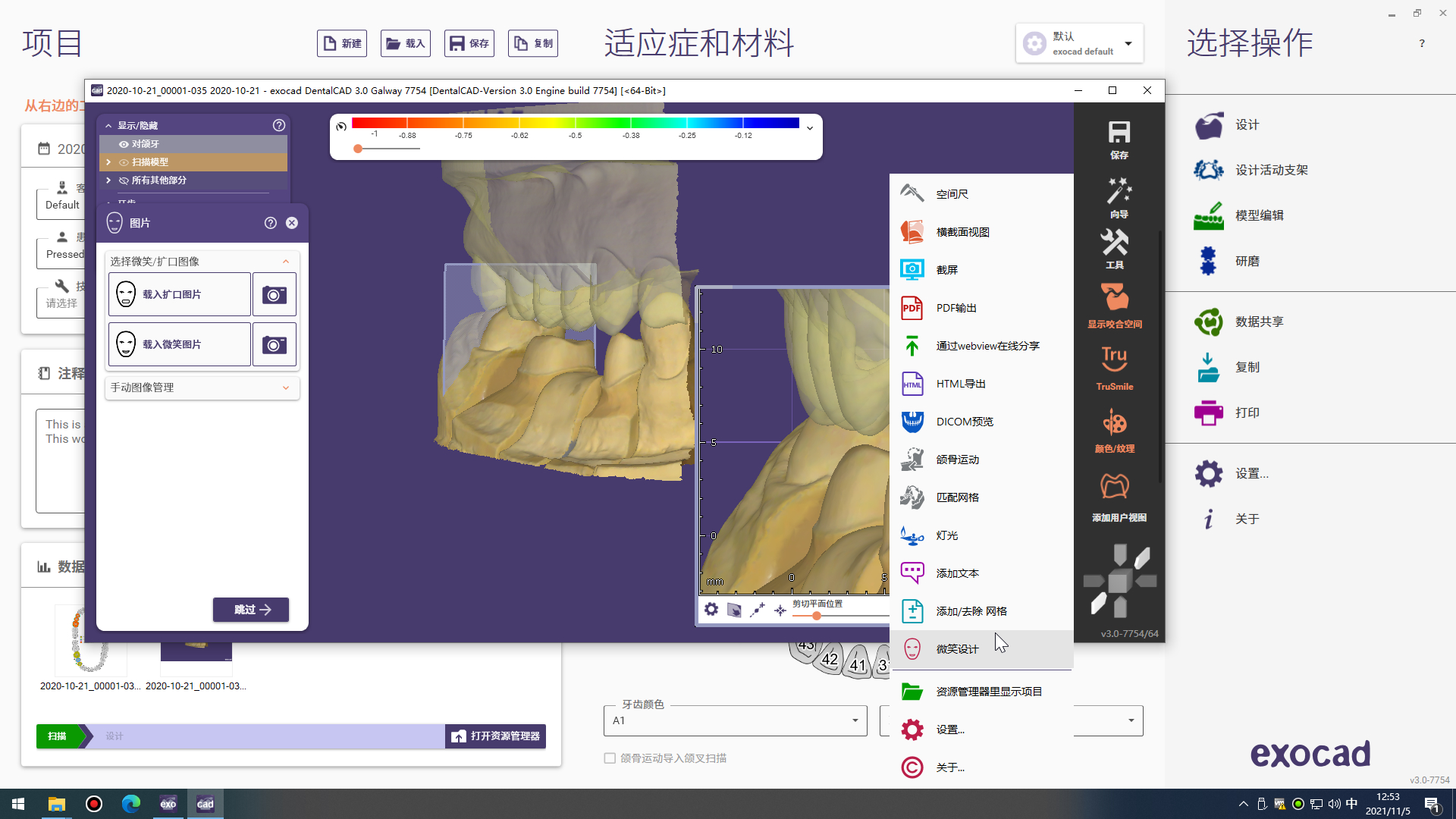 Exocad  DentalCADֻCAD CAMExocad-3.0  7754 (6).jpg