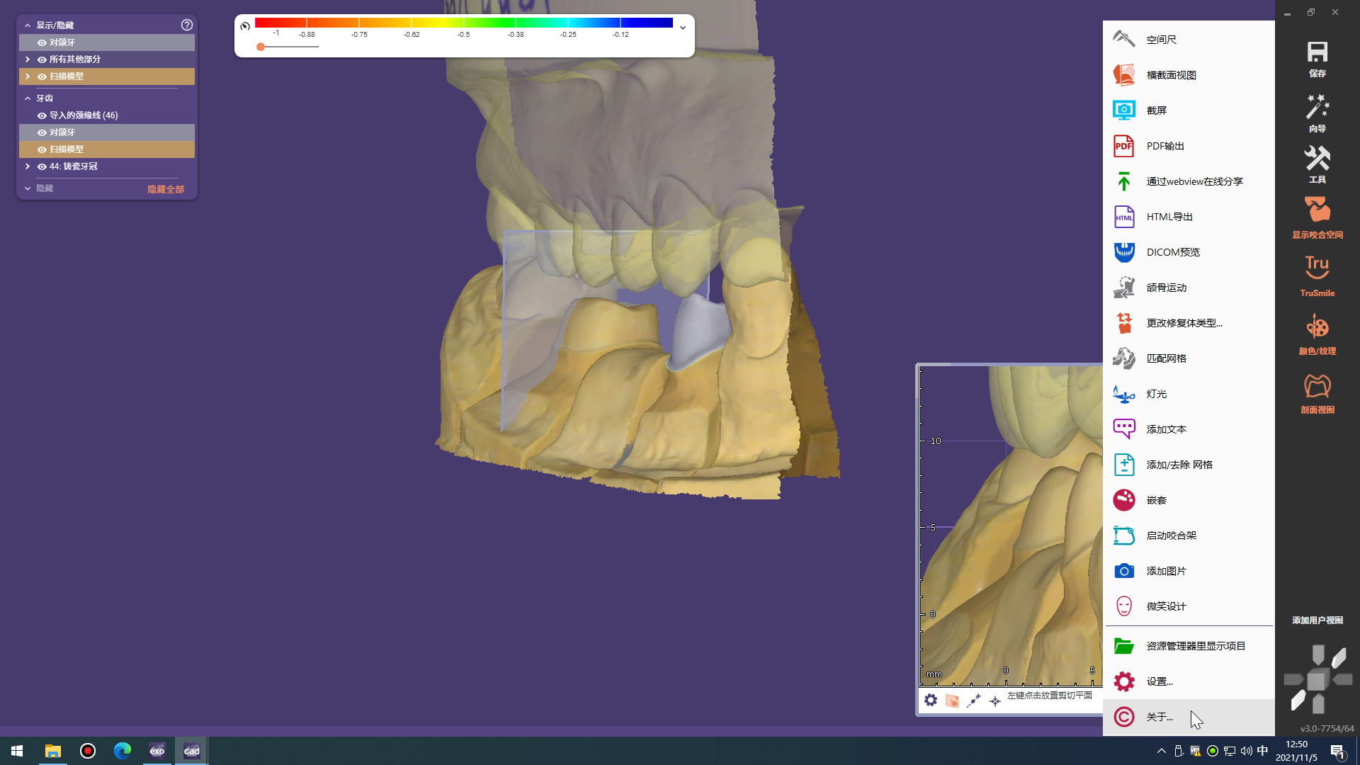 Exocad  DentalCADֻCAD CAMExocad-3.0  7754 (3).jpg