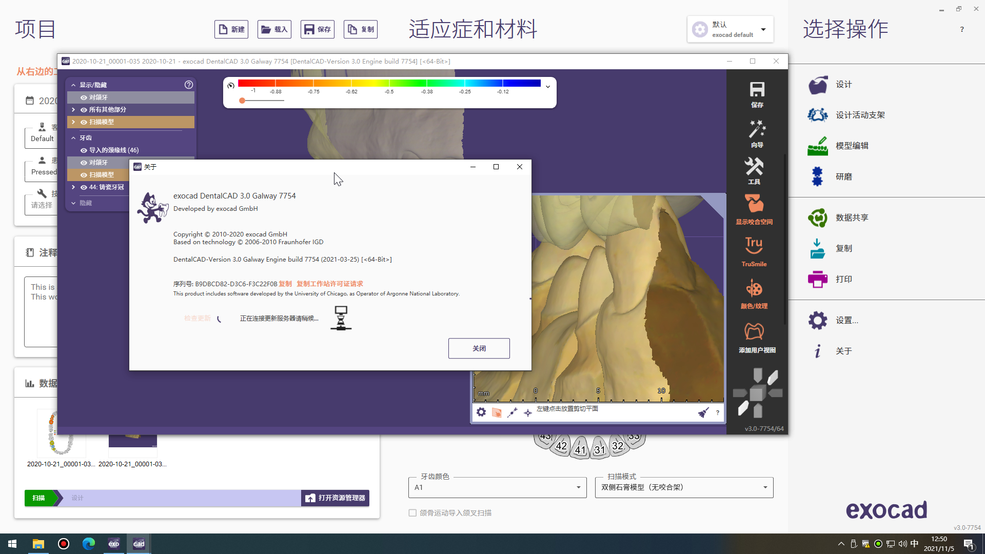 Exocad  DentalCADֻCAD CAMExocad-3.0  7754 (4).jpg